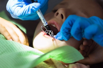 Emergency Tooth Extractions