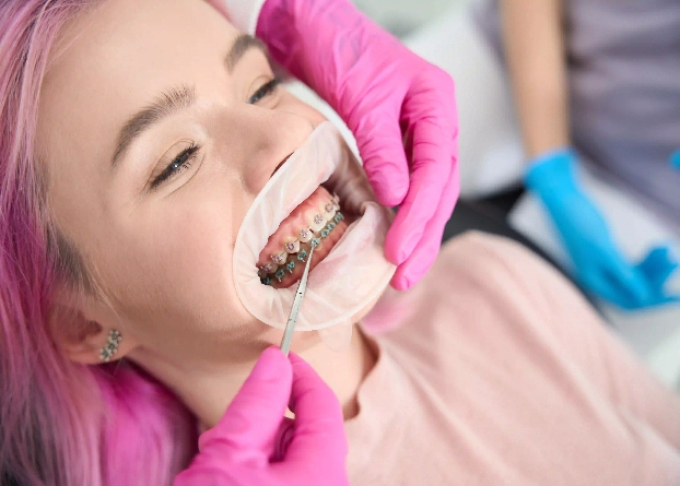Identifying The Ideal Candidate For Orthodontic Care